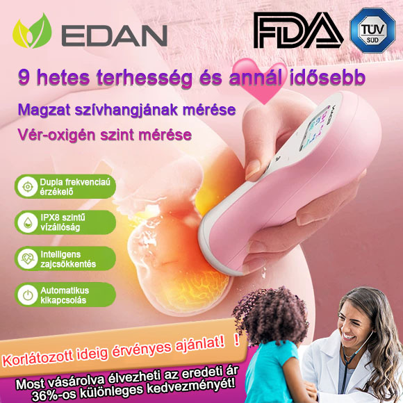 EDAN SD2 terhes nők otthoni magzat Doppler okos teszt hallgató szívfigyelő monitor.